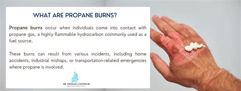 Confronting the Wrath of Liquid Propane Flames: Navigating Burn Injuries on the Skin - A Comprehensive Guide to Managing Burns from Propane Fuel.