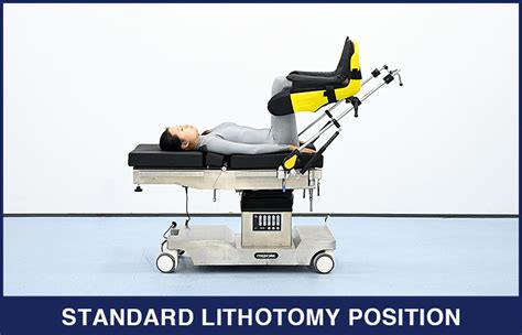 Lithotomy Position: Labor Risks & Safer Alternatives