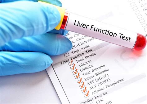 Liver Function Test