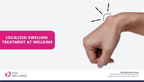 Localized Swelling and Pain