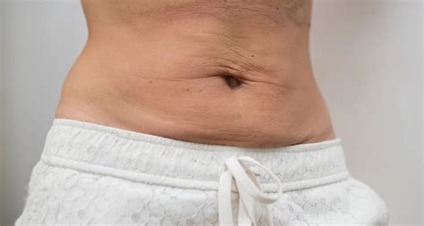 Tighten Your Core: How to Get Rid of Loose Skin Above Your Belly Button