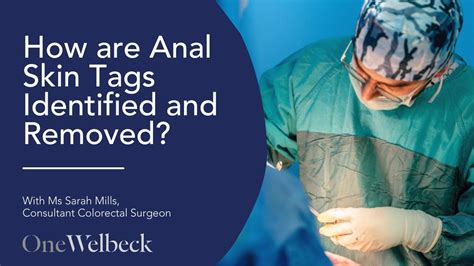 Banish the Bumpy Blemish: A Comprehensive Guide to Dealing with Loose Skin on Anus