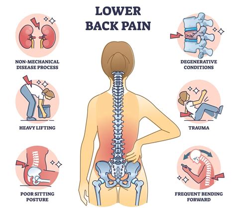 Lower Back Image