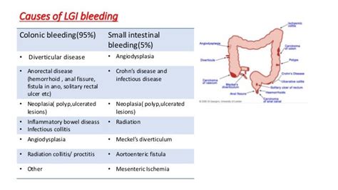 Lower GI Bleeding: Causes & Solutions