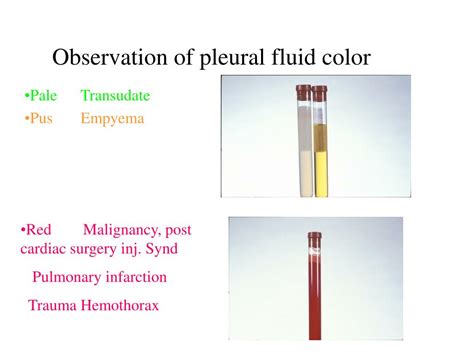 Lung Cancer Pleural Fluid Color Chart