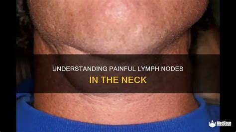 Unlocking the Mystery of Lymph Node Pain: Understanding the Sensation of Touch