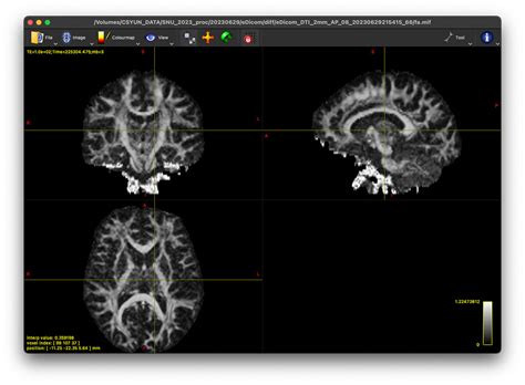 MRtrix3 FA Calculation