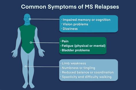 MS Flare-Up Duration Varies Widely: What to Expect