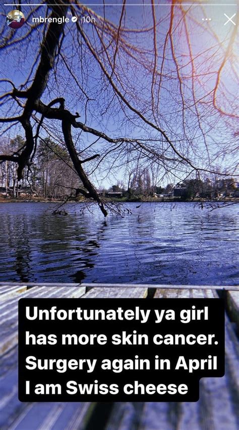 Unmasking the Truth Behind Madison Brengle's Battle with the Big C: A Compelling Story of Perseverance and Hope against Skin Cancer