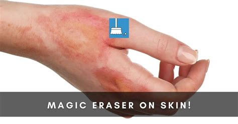 Transform Your Skin Instantly with the Revolutionary Magic Eraser - Bring Your Inner Glow to Light!