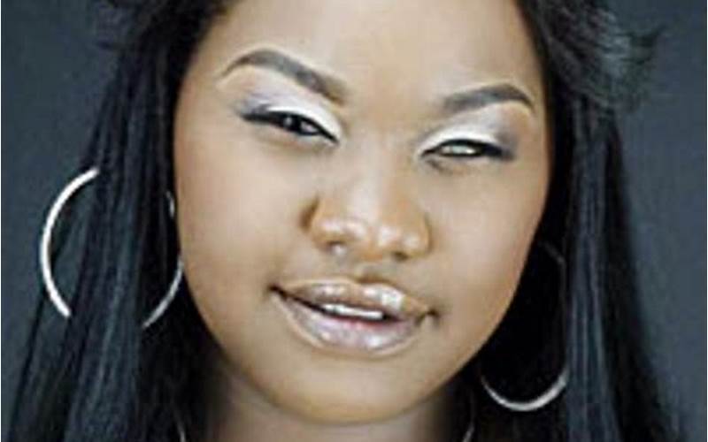 What Happened to Magnolia Shorty’s Eye?