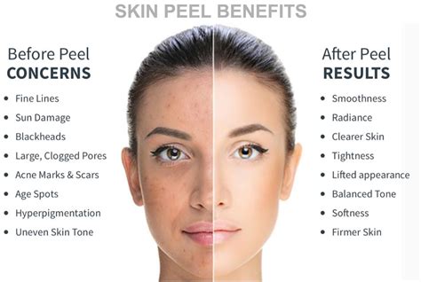 Maintaining a Healthy Weight Peels_For_That_Aged_Skin