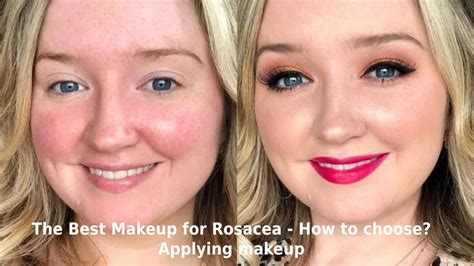 Fierce and Flawless: Unleashing the Power of Makeup for Rosacea Skin