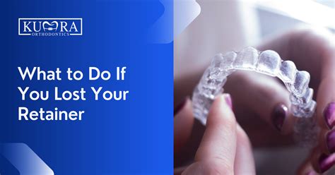 Making Your Retainer Last: Tips and Tricks