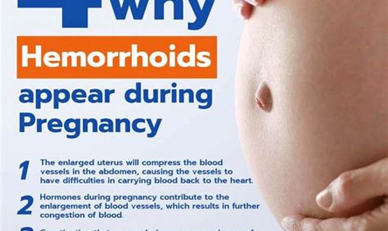 Managing pregnancy-related hemorrhoids
