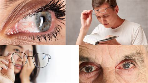 Managing Complex Eye Health Issues