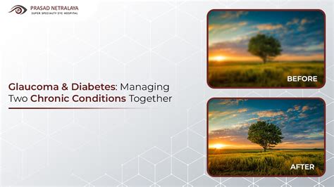 Managing Glaucoma and Retinal Conditions