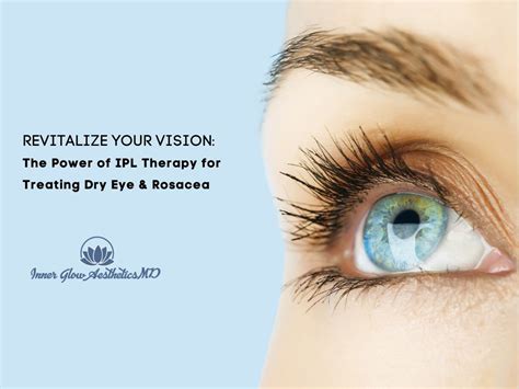 Managing and Treating Spots In Your Eye