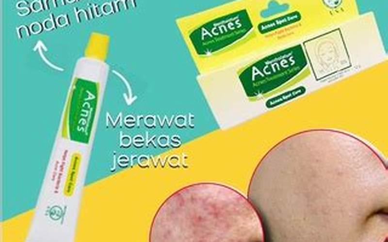 Manfaat Acnes Penghilang Bekas Jerawat