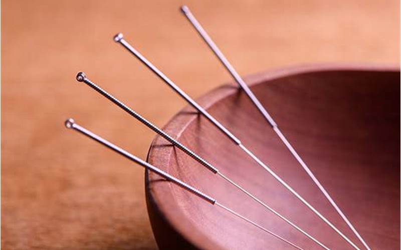 Manfaat Akupunktur