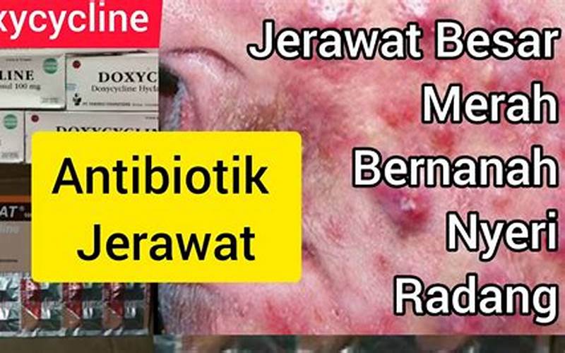 Manfaat Antibiotik Untuk Jerawat