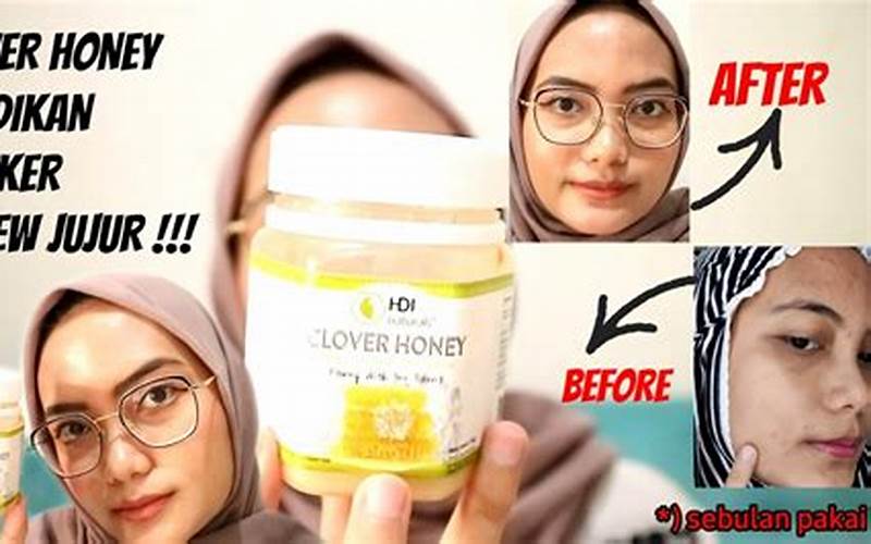 Manfaat Clover Honey Untuk Jerawat