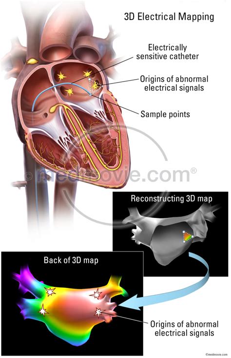 Mapping Electrical Pathways