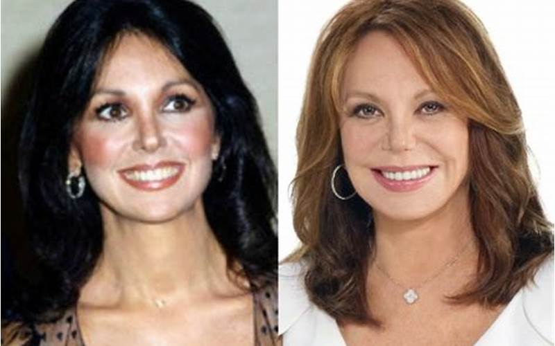 Marlo Thomas After Plastic Surgery