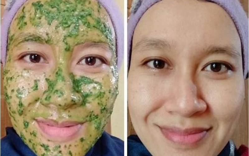 Masker Sirih Cina Untuk Jerawat