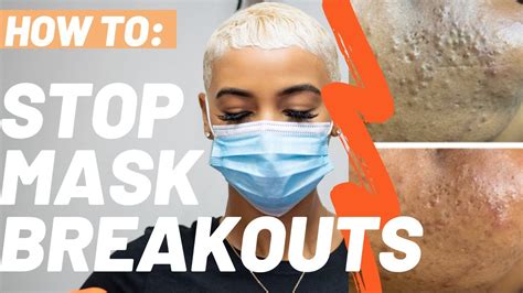 Maskne: Stop Breakouts & Soothe Skin.