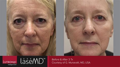 Transform Your Skin and Defy Age with MD Laser Skin & Vein Institute - Your Ultimate Beauty Destination.