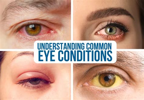 Medical Conditions Associated with Heavy Eyes