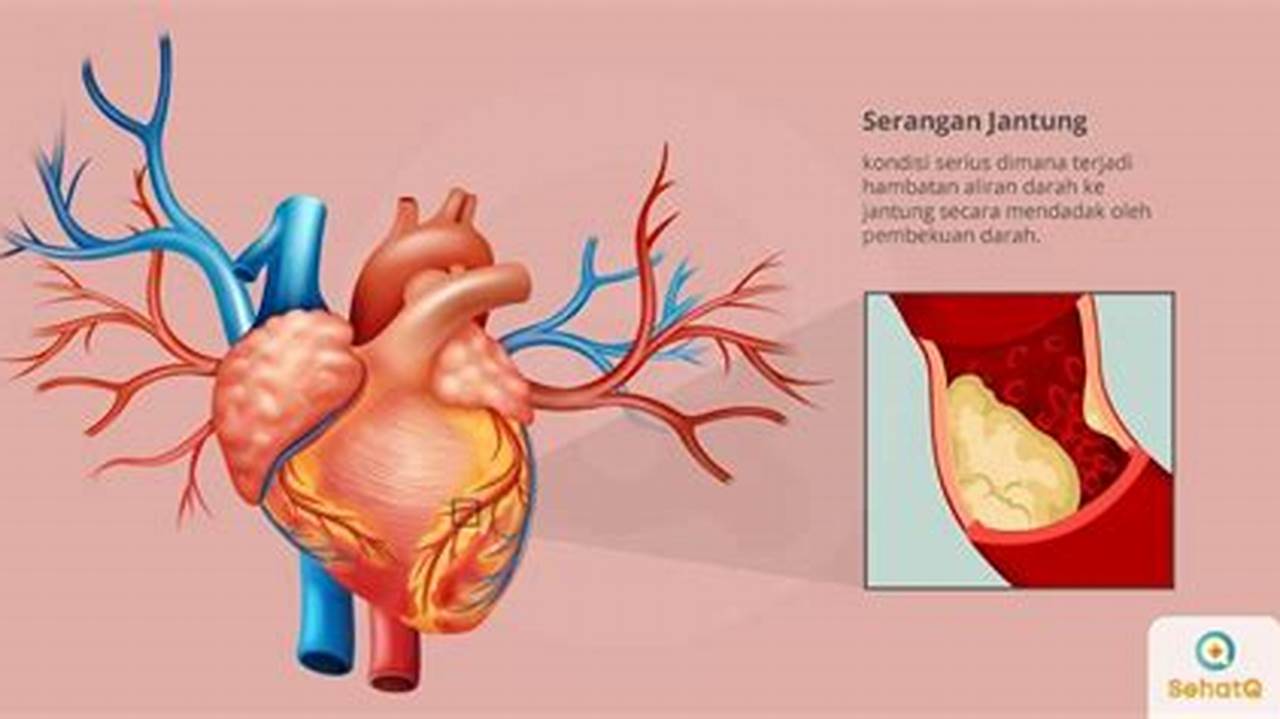 Mencegah Penyakit Jantung, Resep7-10k