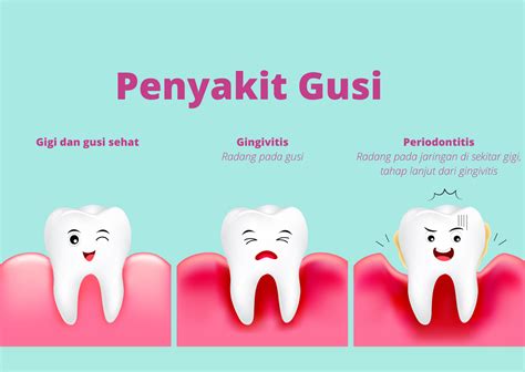 Mencegah Penyakit dan Kerusakan Gigi