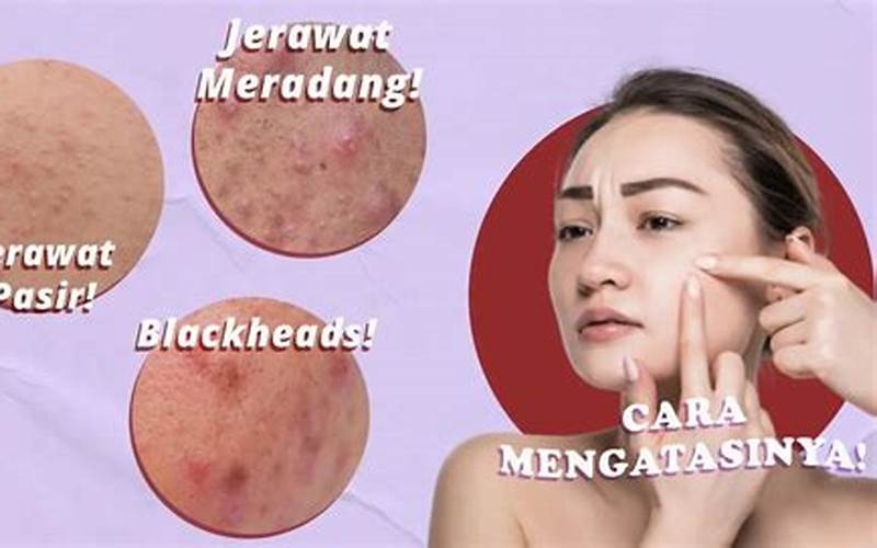 Mengapa Muncul Jerawat?