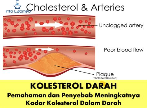 Mengatur Tekanan Darah dan Kadar Kolesterol