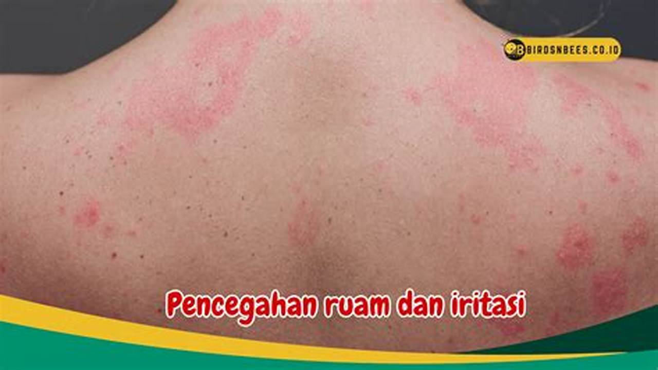 Mengurangi Risiko Iritasi Kulit, Manfaat