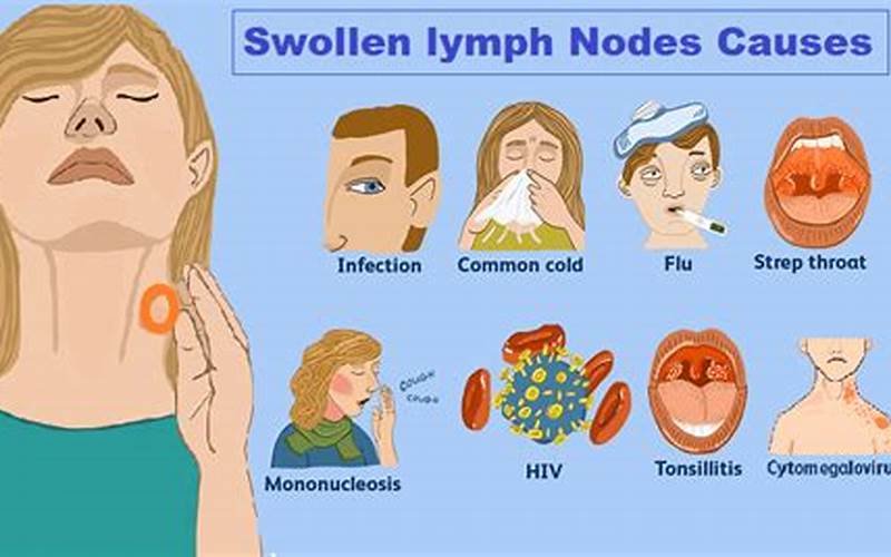 Menstruation And Swollen Lymph Nodes