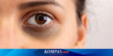 Menyamarkan Lingkaran Hitam