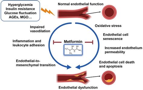 Metformin and Its Modest Impact