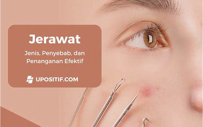 Metronidazole, Penanganan Jerawat Yang Efektif!