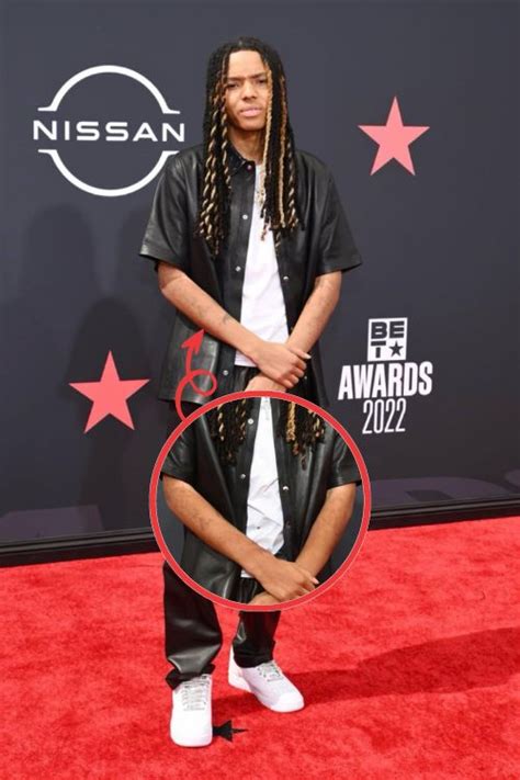 Uncovering the Mystery Behind Michael Epps' Enigmatic Skin Condition: A Comprehensive Insight into the Astonishing Observations