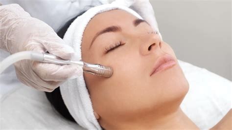 Microdermabrasion