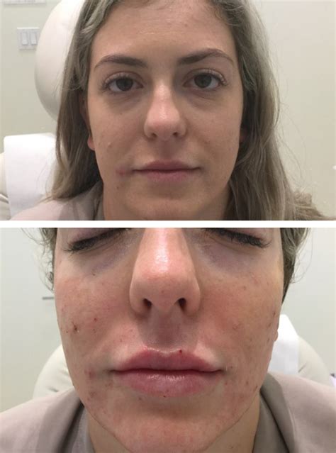 Revamp Your Skin and Rejuvenate Your Look with Mid Atlantic Skin Surgery Institute