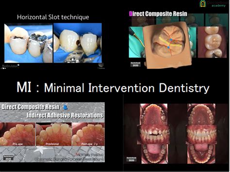 Minimal intervention