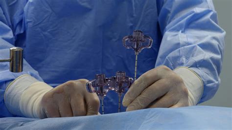 Minimally Invasive Options