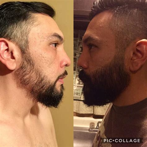 Minox Beard Before And After