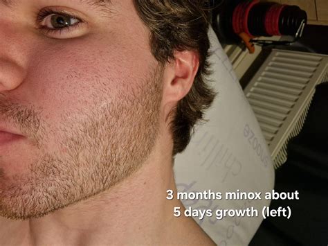 Minox Beards Reddit