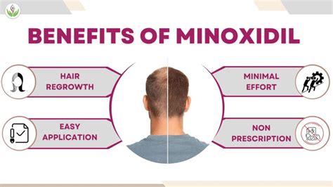 Minoxidil Benefits Image