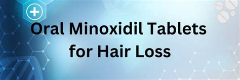 Minoxidil Tablets for Pattern Baldness